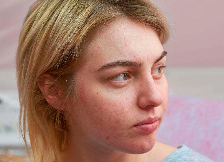 skin-conditions
