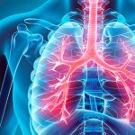 Phlegm and Interstitial Congestion: A Functional Perspective from an Adelaide Naturopath